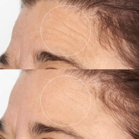 PERRICONE MD High Potency Intensive Smoothing Serum - Picture 2 of 9